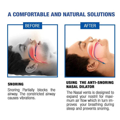 New Blue Silicone 4/8PCS/set Snoring Solution Anti Snoring Devices Snore Nose Vents Nasal Dilators For Better Sleep Sleeping Aid - zzzleep.fi